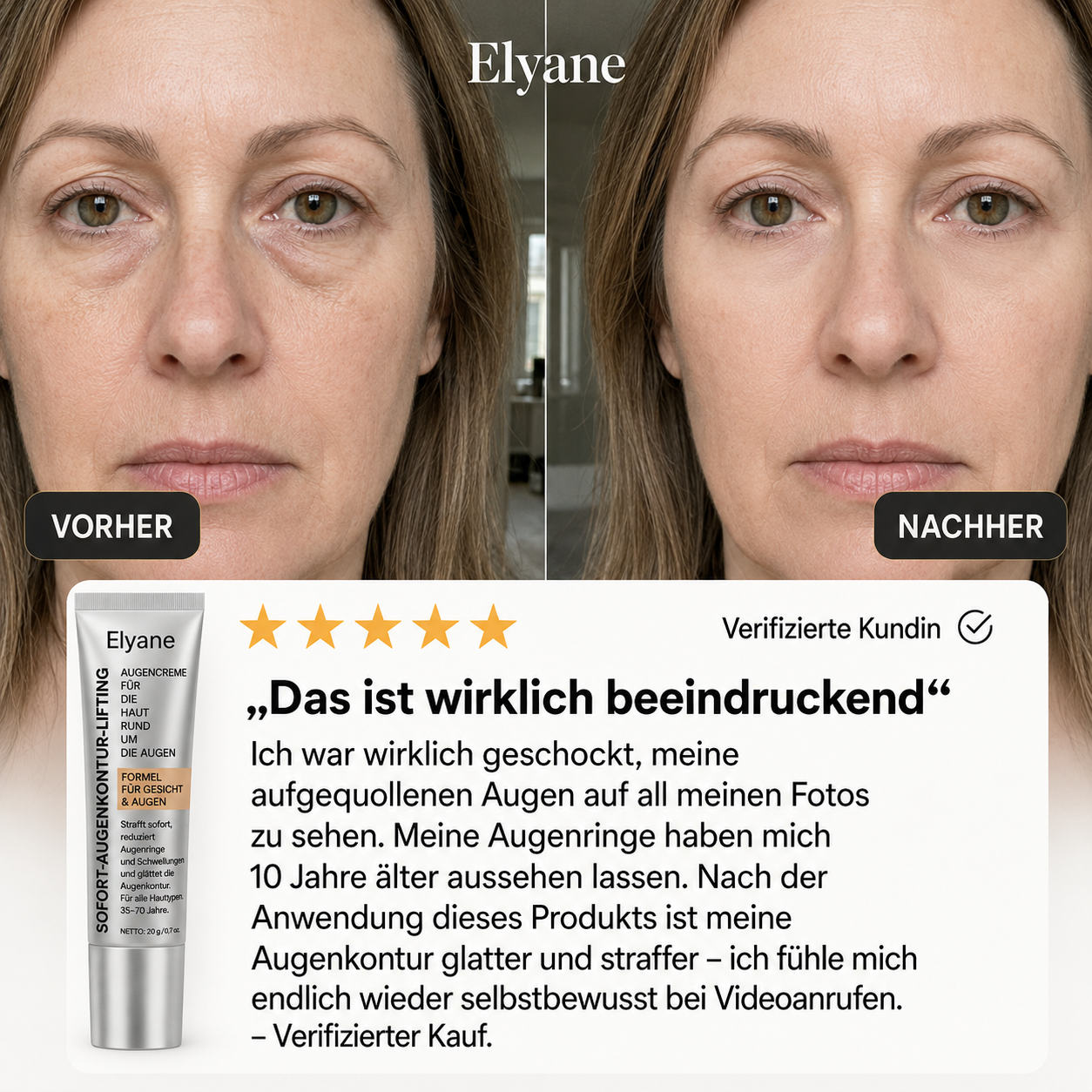 Der Regard Lift von Elyane