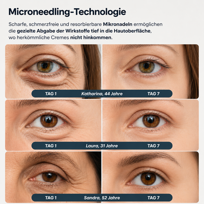 Augenringe-Patches der neuen Generation